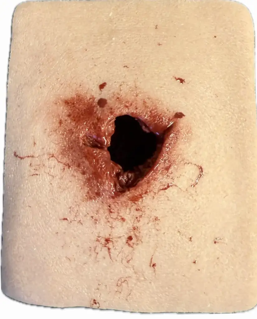 SRP sårskadesimulator  Skottskada