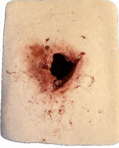 SRP sårskadesimulator  Skottskada